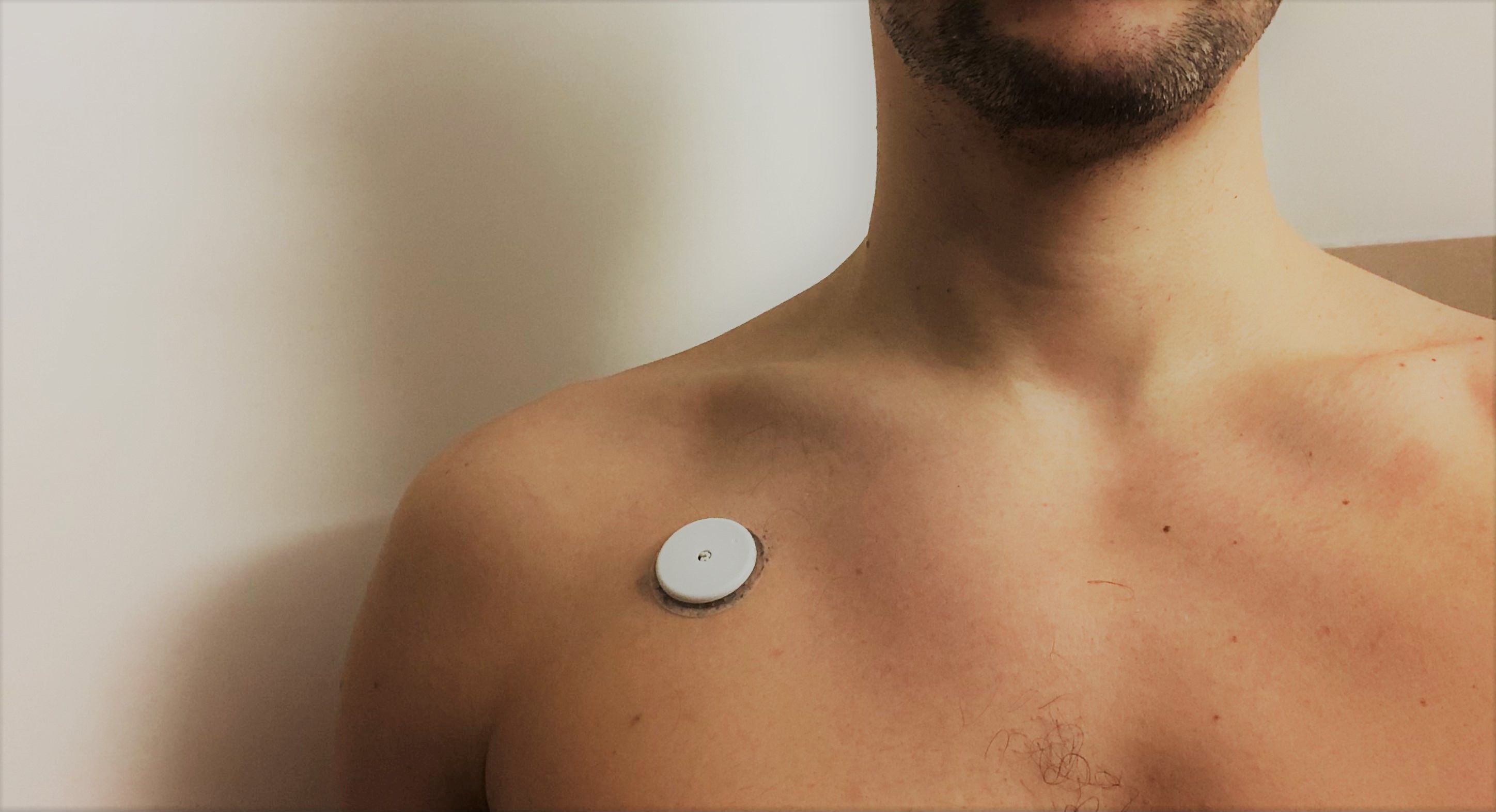 Freestyle Libre 2 continuous glucose monitor sensor attached to chest